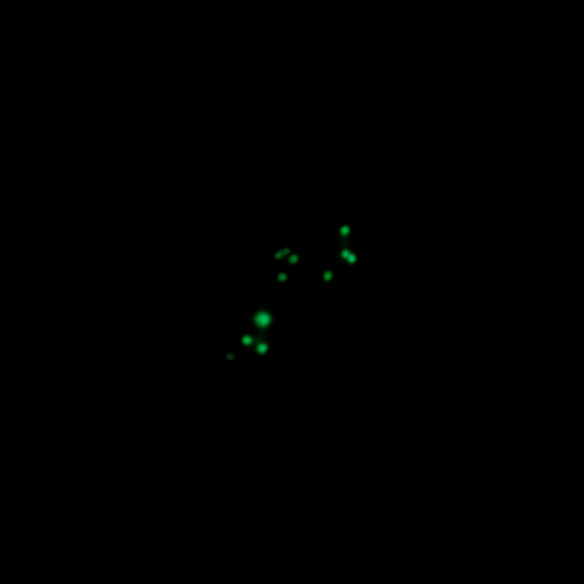 Enchanted Forest Glow UV Glitter Dip Powder